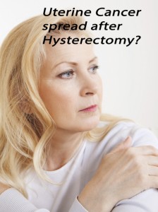 Uterine_Cancer_Hysterectomy_Attorney